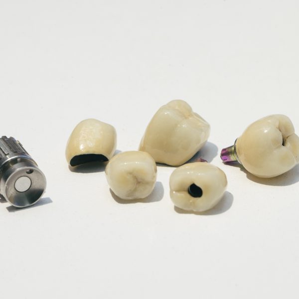 Dental implants teeth